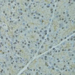 Anti-Alpha 2 Antiplasmin antibody used in IHC (Paraffin sections) (IHC-P). GTX65993