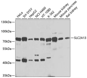 Anti-SLC2A13 antibody used in Western Blot (WB). GTX65995
