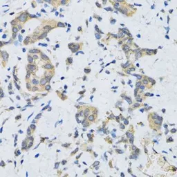 Anti-SLC2A13 antibody used in IHC (Paraffin sections) (IHC-P). GTX65995
