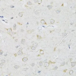 Anti-SLC2A13 antibody used in IHC (Paraffin sections) (IHC-P). GTX65995