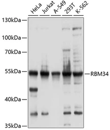 Anti-RBM34 antibody used in Western Blot (WB). GTX66000