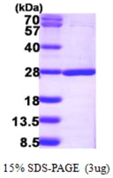 Human NUDT16L1 protein, His tag. GTX66002-pro