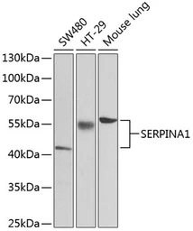 Anti-alpha 1 Antitrypsin antibody used in Western Blot (WB). GTX66005