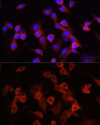 Anti-alpha 1 Antitrypsin antibody used in Immunocytochemistry/ Immunofluorescence (ICC/IF). GTX66005