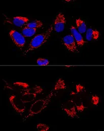 Anti-UQCR10 antibody used in Immunocytochemistry/ Immunofluorescence (ICC/IF). GTX66006