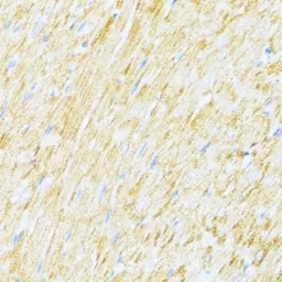 Anti-UQCR10 antibody used in IHC (Paraffin sections) (IHC-P). GTX66006