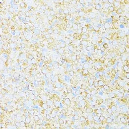 Anti-UQCR10 antibody used in IHC (Paraffin sections) (IHC-P). GTX66006