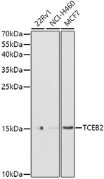 Anti-Elongin B antibody used in Western Blot (WB). GTX66010