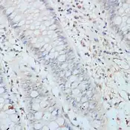 Anti-Elongin B antibody used in IHC (Paraffin sections) (IHC-P). GTX66010