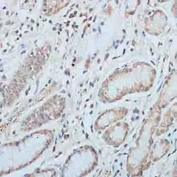 Anti-Elongin B antibody used in IHC (Paraffin sections) (IHC-P). GTX66010