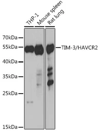 Anti-TIM-3 antibody used in Western Blot (WB). GTX66011