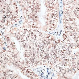 Anti-RBM3 antibody used in IHC (Paraffin sections) (IHC-P). GTX66019