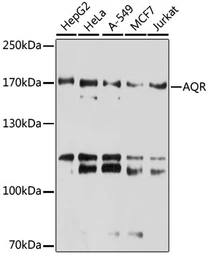Anti-Aquarius antibody used in Western Blot (WB). GTX66020