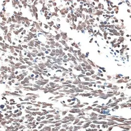 Anti-Aquarius antibody used in IHC (Paraffin sections) (IHC-P). GTX66020