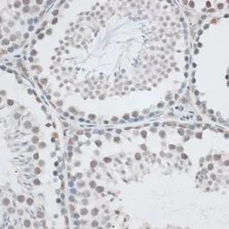 Anti-Aquarius antibody used in IHC (Paraffin sections) (IHC-P). GTX66020