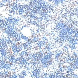 Anti-Aquarius antibody used in IHC (Paraffin sections) (IHC-P). GTX66020