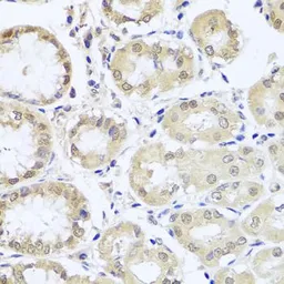 Anti-hCG beta 7 antibody used in IHC (Paraffin sections) (IHC-P). GTX66027