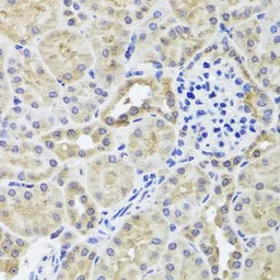 Anti-hCG beta 7 antibody used in IHC (Paraffin sections) (IHC-P). GTX66027