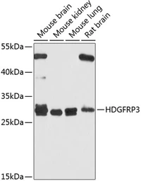 Anti-HDGFRP3 antibody used in Western Blot (WB). GTX66028