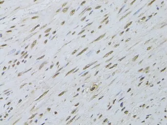 Anti-HDGFRP3 antibody used in IHC (Paraffin sections) (IHC-P). GTX66028