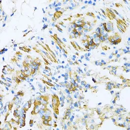 Anti-VAMP1 antibody used in IHC (Paraffin sections) (IHC-P). GTX66029