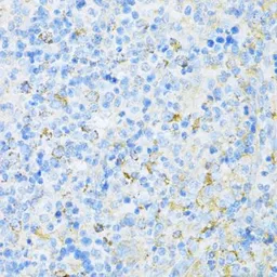 Anti-VAMP1 antibody used in IHC (Paraffin sections) (IHC-P). GTX66029