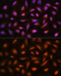 Anti-CtBP2 antibody used in Immunocytochemistry/ Immunofluorescence (ICC/IF). GTX66034