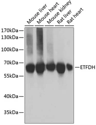 Anti-ETFDH antibody used in Western Blot (WB). GTX66035
