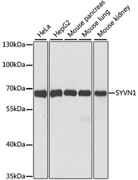 Anti-SYVN1 antibody used in Western Blot (WB). GTX66037
