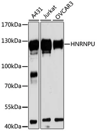 Anti-hnRNP U antibody used in Western Blot (WB). GTX66039
