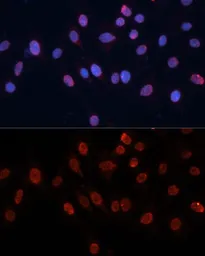 Anti-hnRNP U antibody used in Immunocytochemistry/ Immunofluorescence (ICC/IF). GTX66039