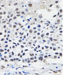 Anti-hnRNP U antibody used in IHC (Paraffin sections) (IHC-P). GTX66039