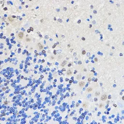 Anti-hnRNP U antibody used in IHC (Paraffin sections) (IHC-P). GTX66039