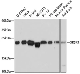 Anti-SFRS3 antibody used in Western Blot (WB). GTX66040