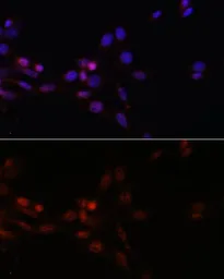 Anti-SFRS3 antibody used in Immunocytochemistry/ Immunofluorescence (ICC/IF). GTX66040