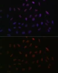 Anti-SFRS3 antibody used in Immunocytochemistry/ Immunofluorescence (ICC/IF). GTX66040