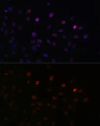 Anti-SFRS3 antibody used in Immunocytochemistry/ Immunofluorescence (ICC/IF). GTX66040