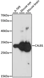 Anti-Calbindin antibody used in Western Blot (WB). GTX66044