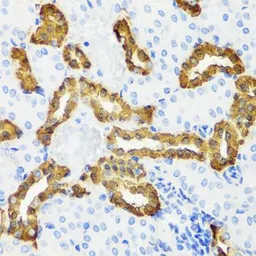 Anti-Calbindin antibody used in IHC (Paraffin sections) (IHC-P). GTX66044