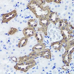 Anti-Calbindin antibody used in IHC (Paraffin sections) (IHC-P). GTX66044