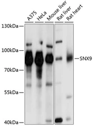 Anti-SNX9 antibody used in Western Blot (WB). GTX66045
