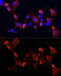 Anti-CLUH antibody used in Immunocytochemistry/ Immunofluorescence (ICC/IF). GTX66049