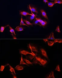 Anti-CLUH antibody used in Immunocytochemistry/ Immunofluorescence (ICC/IF). GTX66049