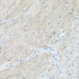 Anti-CLUH antibody used in IHC (Paraffin sections) (IHC-P). GTX66049