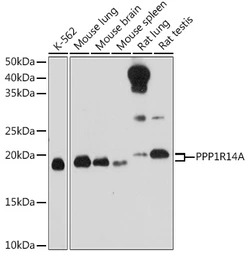 Anti-CPI-17 antibody used in Western Blot (WB). GTX66050