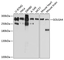 Anti-GOLGA4 antibody used in Western Blot (WB). GTX66053