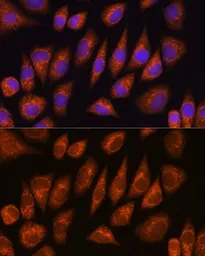 Anti-GOLGA4 antibody used in Immunocytochemistry/ Immunofluorescence (ICC/IF). GTX66053