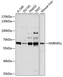 Anti-HNRPLL antibody used in Western Blot (WB). GTX66056