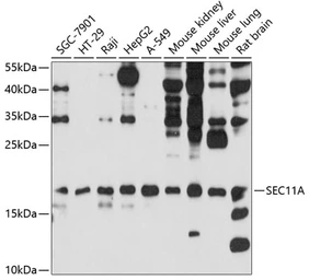 Anti-SEC11A antibody used in Western Blot (WB). GTX66062