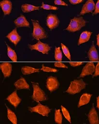 Anti-SEC11A antibody used in Immunocytochemistry/ Immunofluorescence (ICC/IF). GTX66062